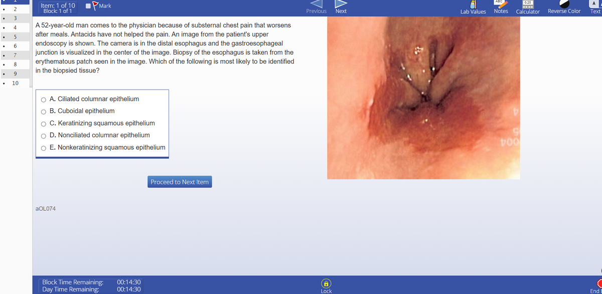 Step 1 style question on oesophageal epithelium with a clinical image